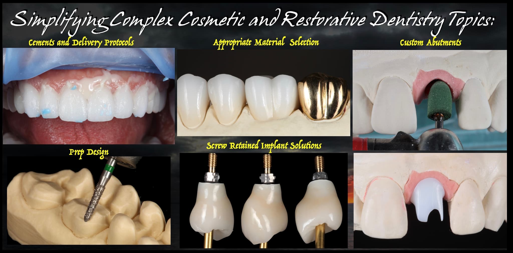 Crown and bridge prep design, cementation, and screw-retained restoration cases from the Strupp & Brumm clinical archive
