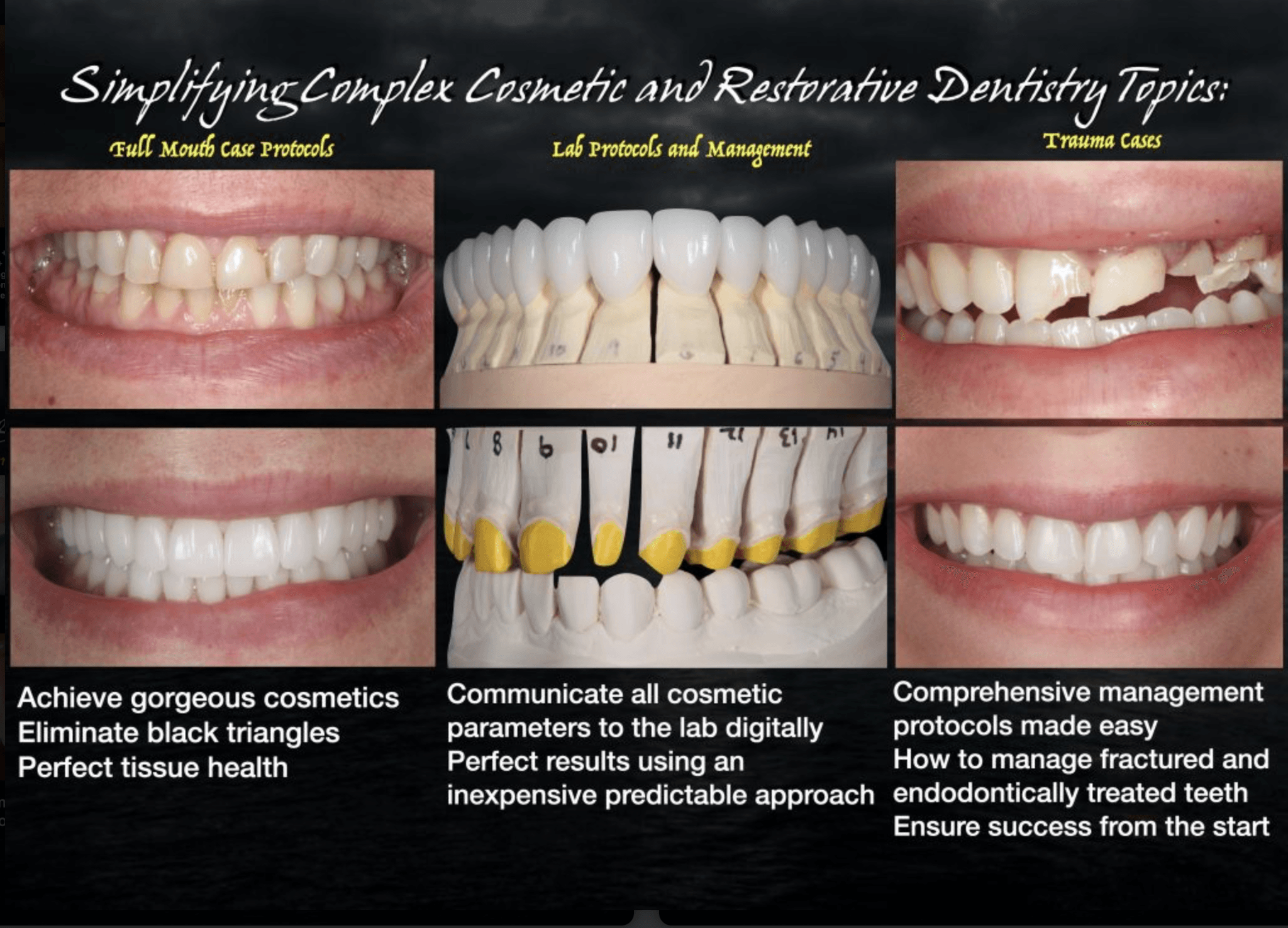 Full-mouth restoration and traumatic anterior cases from the Strupp & Brumm clinical archive