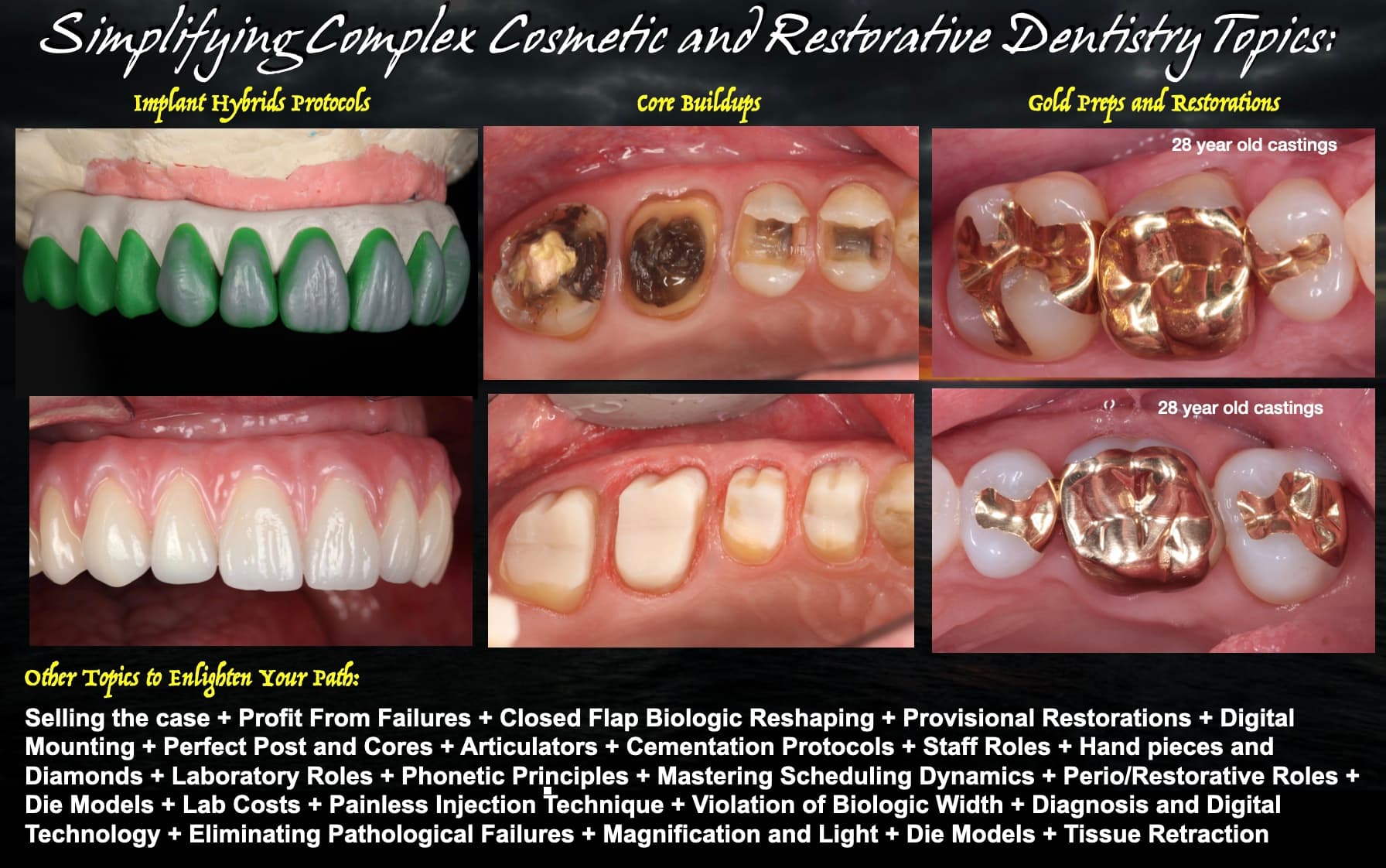 Cast gold onlay, post and core, and structural buildup cases from the Strupp & Brumm clinical archive