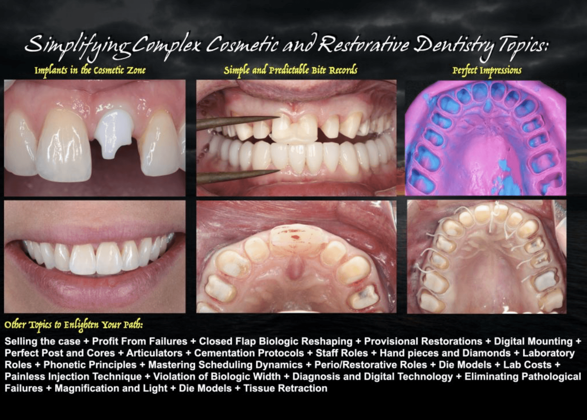 Single-tooth and multi-unit implant restorations from the Strupp & Brumm clinical archive
