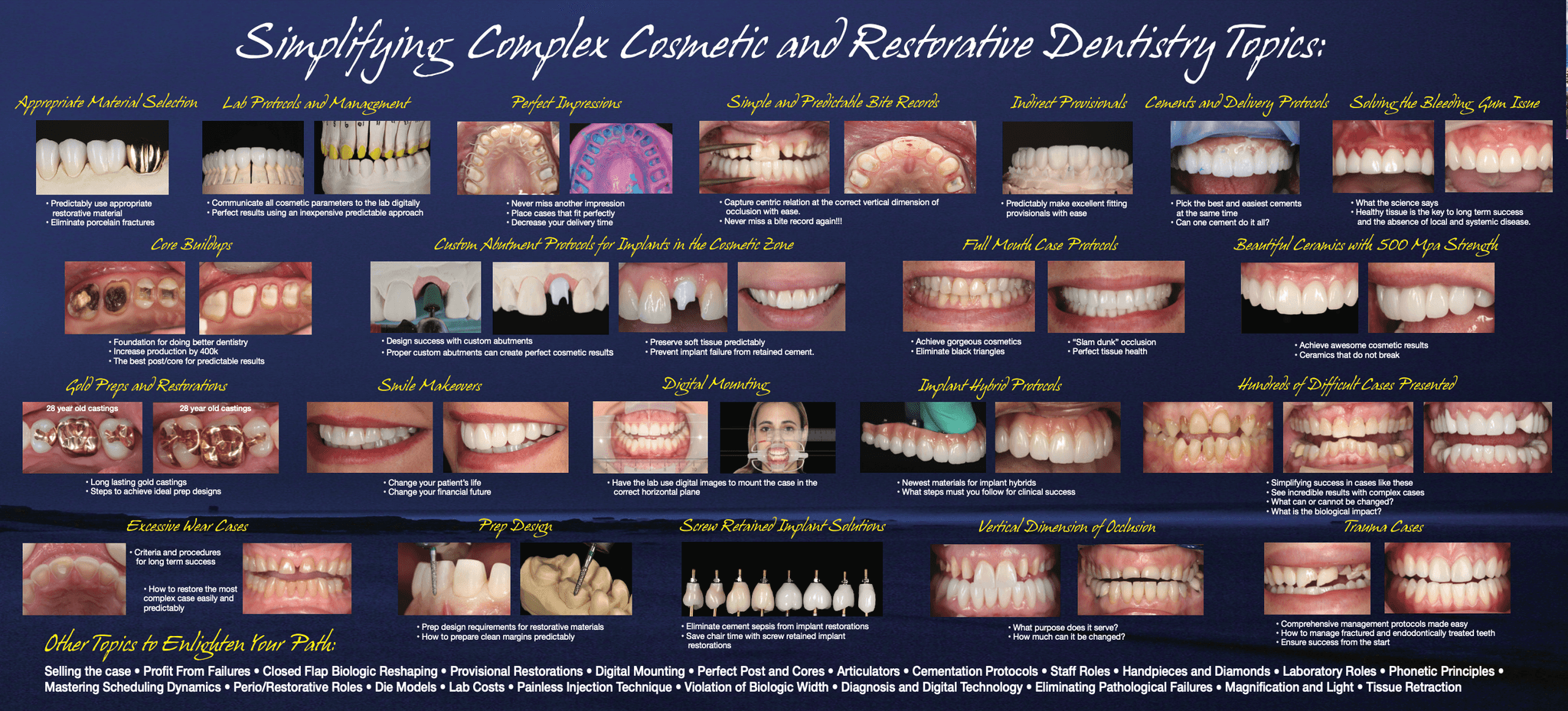 Full Simplifying Complex Cosmetic & Restorative Dentistry curriculum poster — every clinical topic, with before-and-after cases